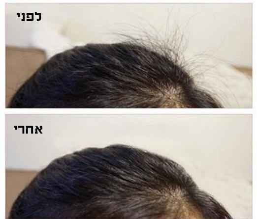 מברשת להעלמת שוונצים בשיער - SiliCoverstore