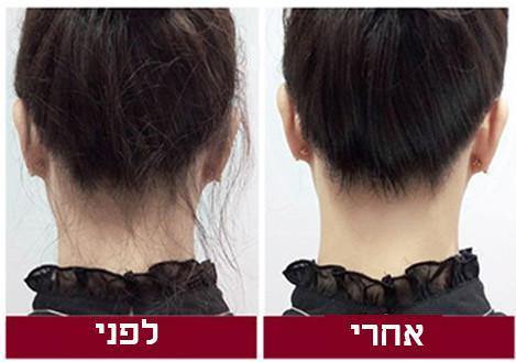 מברשת להעלמת שוונצים בשיער - SiliCoverstore